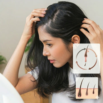 Hair Fall