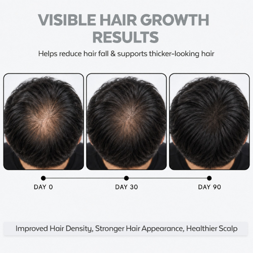 intense growth hair serum 