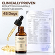 anti hair fall serum