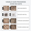 intense growth hair serum 