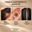 hair fall treatment