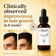 intense growth hair serum